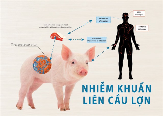 uu888 one ghi nhận ca nhiễm liên cầu khuẩn lợn tại phường Việt Hưng